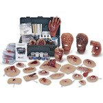 Simulaids 800-028 Xtreme Trauma Deluxe Moulage Kit